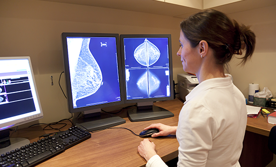 Breaking News: Sellas Announces Promising Data on NeuVax in Combination with Herceptin in HER2 1+/2+ Breast Cancer