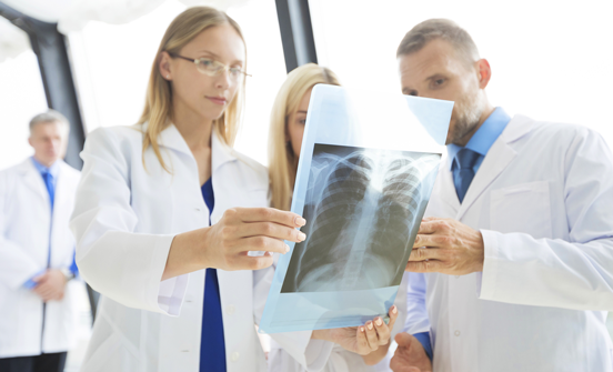 Understanding Esophageal Cancer