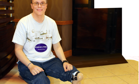My New Perspective After Losing a Leg to Cancer
