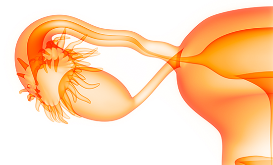 What You Need to Know About Ovarian Cancer