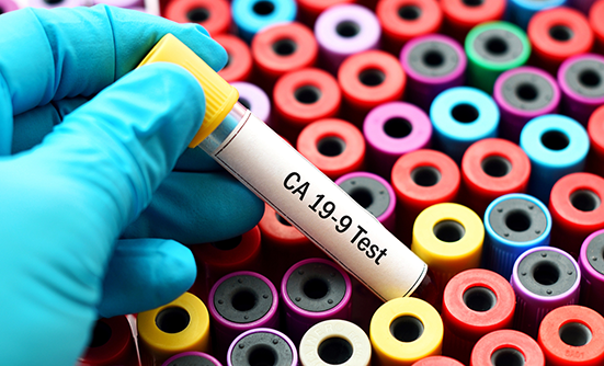 What Are Cancer Biomarkers, and Why Are They Important?