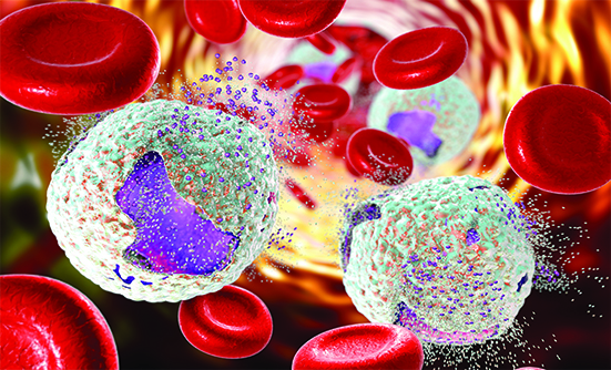First-Line Calquence-Based Combination Therapy for Patients with Chronic Lymphocytic Leukemia
