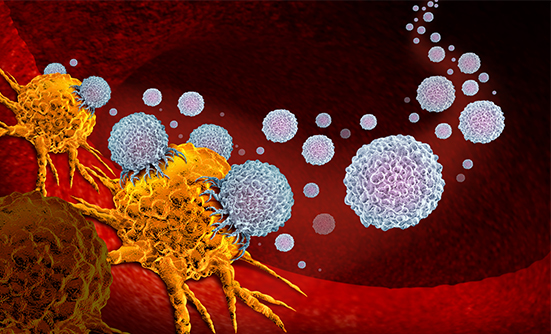 Combination Immunotherapy with Opdivo and Yervoy in Patients with Advanced Biliary Tract Cancer