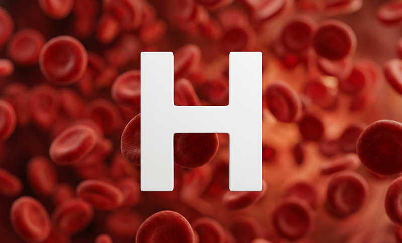 H is for…