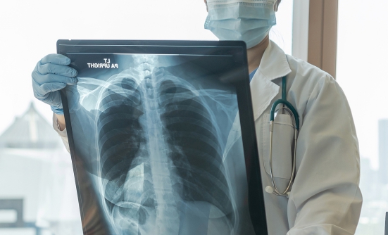 Lung Cancer Screening Could Save Your Life